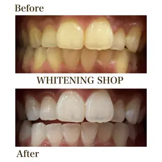 ホワイトニングショップ静岡葵区店所属・ホワイトニング ショップ静岡葵区店のその他イメージ