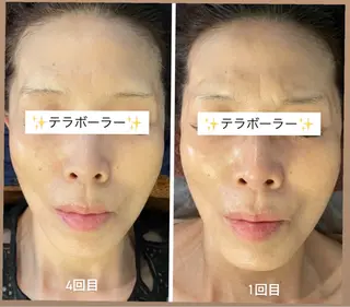 耳ツボ/体質改善/ 温活La mer月島のその他イメージ