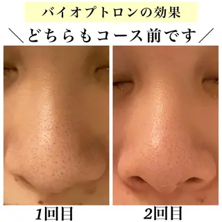 Bellesthe （ベルエステ）のエステ・リラクイメージ