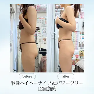 espresso,所属・《痩身、小顔専門店》 エスプレッソのエステ・リラクイメージ