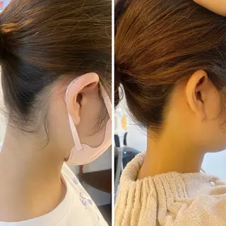 うなじ脱毛/美肌脱毛 LABELのエステ・リラクイメージ