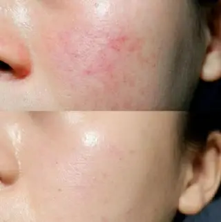 aliaハイフ&水光ジェットサロン所属・aliaハーブ水光店 エステティシャン募集のエステ・リラクイメージ