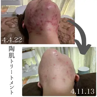 aimee　肌質改善サロン【アイミー】所属・肌質改善サロン aimee｜アイミーのエステ・リラクイメージ