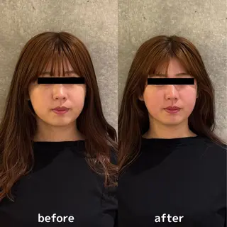 美容整体師 菅原力也 姿勢/小顔/目黒のエステ・リラクイメージ