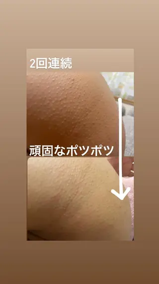 【足圧】鬼👹リンパ 身体整うサロンのエステ・リラクイメージ