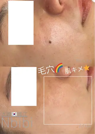 韓国🇰🇷価格 サロン_Nbibiのエステ・リラクイメージ