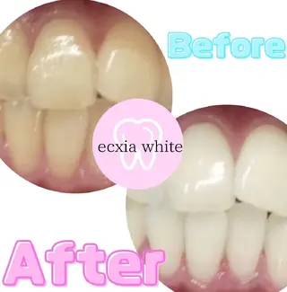 ecxia  white 　広島袋町店所属・セルフホワイトニング エクシア広島袋町店のその他イメージ