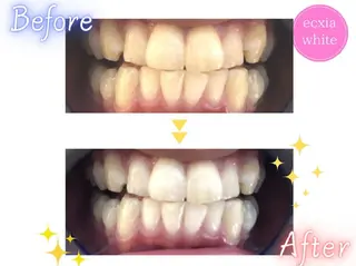 メンズ エクシアホワイトニング草津店所属・nanami -ホワイトニングのその他イメージ