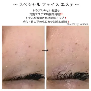 ビューティー ミロワールのエステ・リラクイメージ
