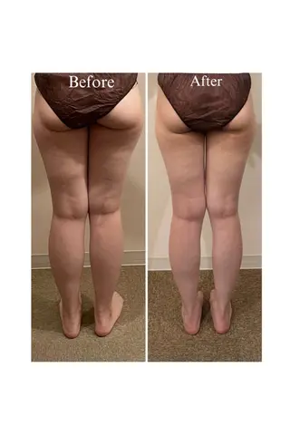 中尾 朱里のエステ・リラクイメージ