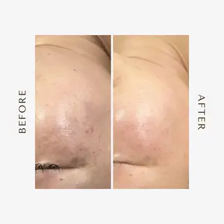 1st｜フェイシャル エステ専門店のエステ・リラクイメージ