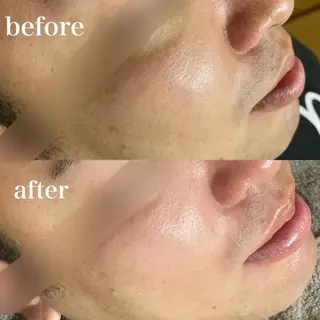 磐田｜LAYLA 一番丁寧な脱毛店のエステ・リラクイメージ