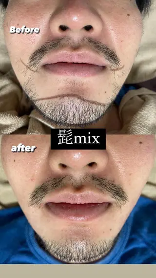 メンズ Epina 千葉店 【エピナ】のエステ・リラクイメージ