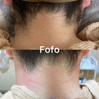 ピーリング・脱毛・ブラジリアンワックス専門店【Fofo仙台泉区店】所属・ピーリング・脱毛専門 Fofo泉区店のその他イメージ