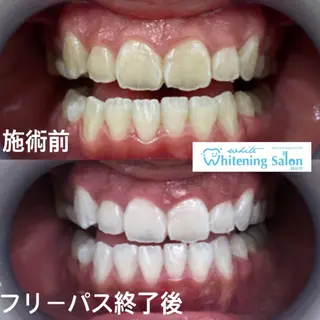 ホワイトニング&アイラッシュ四日市ホワイト所属・アイラッシュ ホワイトニング四日市のマツエク・マツパデザイン