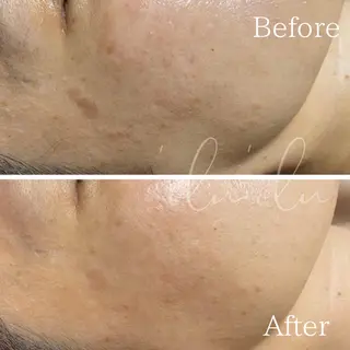 〈医療提携/毛穴・シミケア専門店〉 'Olu'Olu【オルオル】所属・'Olu'Olu シミ・毛穴専門サロンのエステ・リラクイメージ