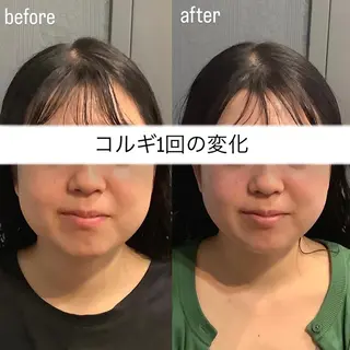 エステサロンino.colore'所属・小顔サロン ino.coloreのエステ・リラクイメージ