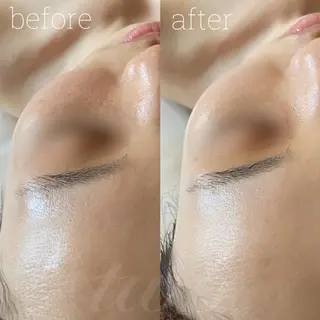 《心斎橋》 twoのエステ・リラクイメージ