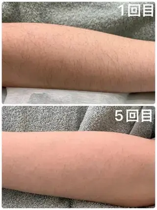 脱毛＆フェイシャル MIEUX心斎橋店のエステ・リラクイメージ