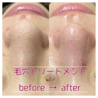 〜小顔・痩身・リラクゼーション〜　　Y&o Esthetic  Salon所属・HANA MIKIの眉毛・アイブロウイメージ