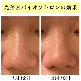 Bellesthe （ベルエステ）のエステ・リラクイメージ