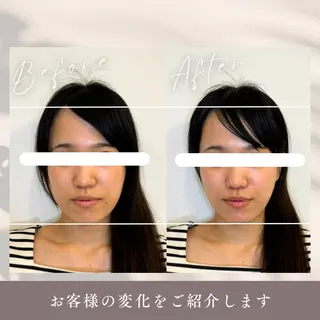 小顔矯正&美容整体 整え屋REDのエステ・リラクイメージ
