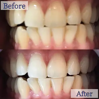 LBSホワイトニング 新宿店💝店長熊倉のその他イメージ