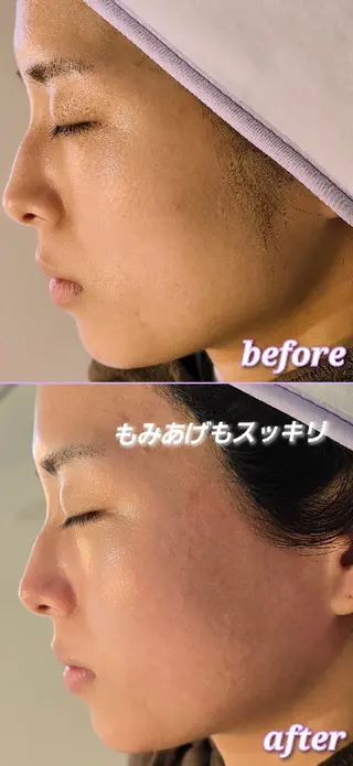 facial salon Lily所属・salon Lilyのエステ・リラクイメージ