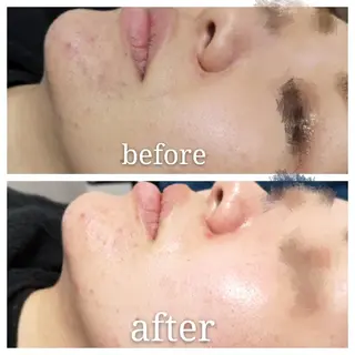 🅖🅤🅩🅔🅛 salonのエステ・リラクイメージ