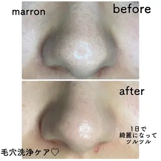 marron所属・痩身ハイパーナイフ ララピールリアボーテのエステ・リラクイメージ