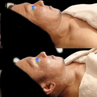 メンズ Ciel～天国リラクゼーションサロン～所属・極上体験～Ciel～ 今井 いちごのエステ・リラクイメージ