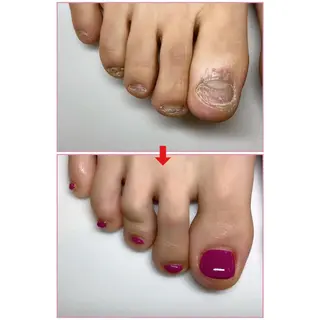 ネイル ネイルサロンアリューム所属・ネイルサロン アリュームのネイルデザイン