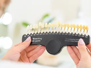 ホワイトニングビューティー松戸店所属・ホワイトニング ビューティー松戸店のその他イメージ