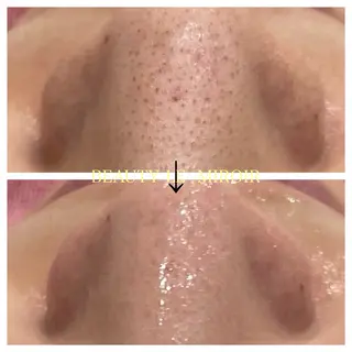 ビューティー ミロワールのエステ・リラクイメージ