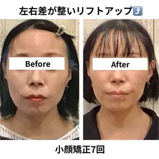 渋谷小顔矯正 毛穴洗浄ウミのエステ・リラクイメージ