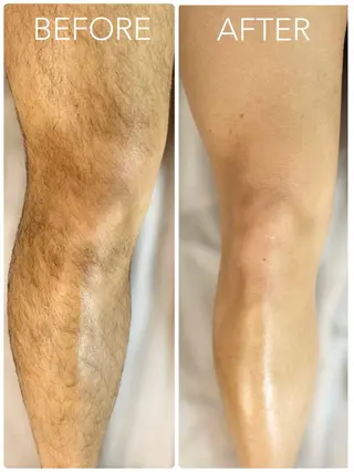 メンズ TREE WAX脱毛のエステ・リラクイメージ