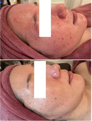 Beauty Max所属・Beauty Max 大石のエステ・リラクイメージ