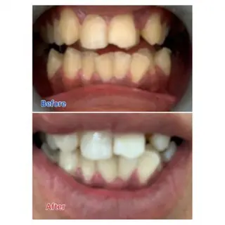 M渋谷店所属・Ｍ渋谷 ホワイトニングのエステ・リラクイメージ