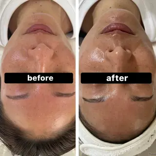 脱毛＆Beauty salon IILA所属・垢抜けお手伝い💖 Sakuraの眉毛・アイブロウイメージ