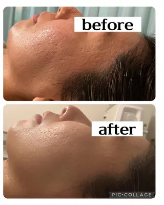 Dione湘南藤沢店 ×LUANA　齋藤のエステ・リラクイメージ