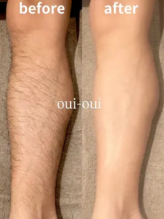 oui-oui　ウィウィ所属・oui-oui 磐田脱毛のエステ・リラクイメージ