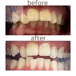 ホワイトニング ショップ船橋店🦷のエステ・リラクイメージ