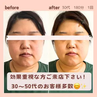 小顔矯正& 慢性肩こり腰痛改善店のエステ・リラクイメージ
