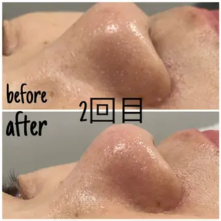 毛穴洗浄・痩身・脱毛 /アルカンジュのエステ・リラクイメージ