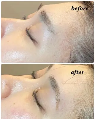 アイブロウ ハーブピーリング/韓国肌管理/フェイシャル/毛穴洗浄/眉毛/顔脱毛【糸脱毛専門】rev所属・ハーブピーリング🌹 毛穴洗浄❤️眉waxのエステ・リラクイメージ