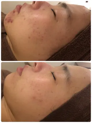 ミディアム カラー パーマ ヘアアレンジ メンズ キッズ ネイル マツエク・マツパ ニキビ・肌質改善専門 ♡人生が変わるサロンのエステ・リラクイメージ