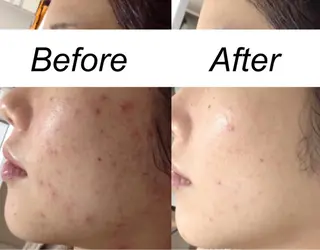 ミディアム カラー パーマ ヘアアレンジ キッズ ネイル マツエク・マツパ 都度払い肌質改善 &脱毛Blancheのエステ・リラクイメージ