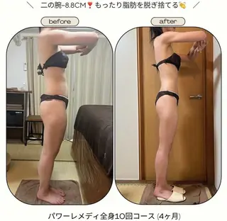 biloop所属・《本気痩せ×疲労改善 》  BILOOPのエステ・リラクイメージ