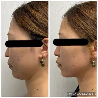 BeautySalonGemmy所属・Gemmy 愛美のエステ・リラクイメージ