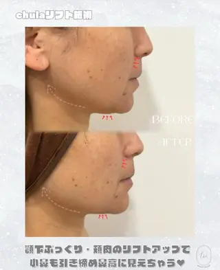 chulanail所属・arisa .のエステ・リラクイメージ